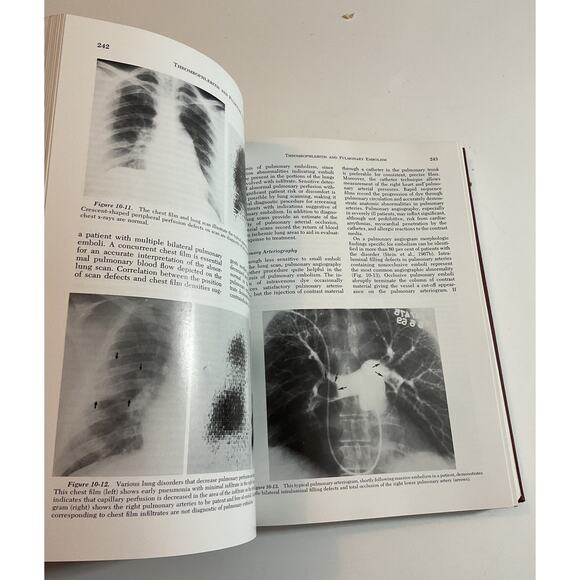 1971 Hardback Critical Surgical Illness by James D. Hardy - Picture 7 of 8